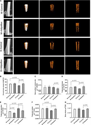 AdipoRon Promotes the Osseointegration of Dental Implants in Mice With Type 2 Diabetes Mellitus